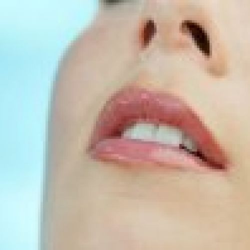 Dientes alineados con ortodoncia en Valladolid