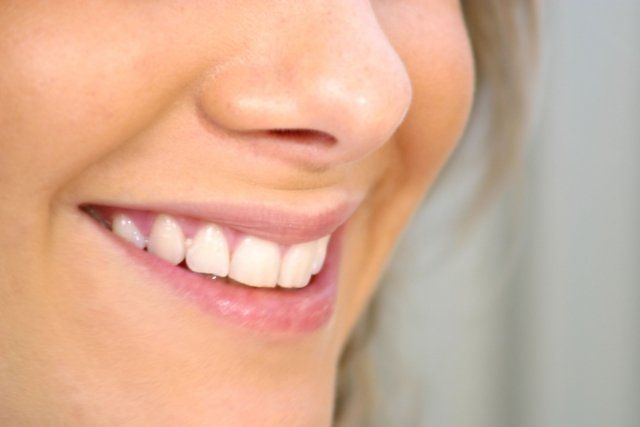 Sonrisa perfecta con dientes blanqueados