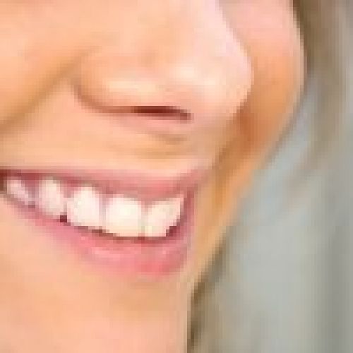 Sonrisa con dientes perfectos