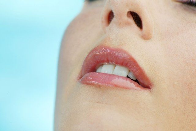 Dientes alineados con ortodoncia en Valladolid